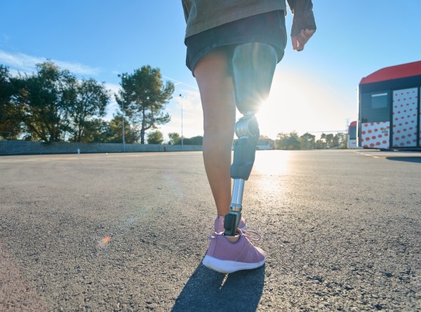 Você Acredita Nisso? 7 Mitos Sobre o Uso de Próteses Que Estão Atrasando Sua Recuperação